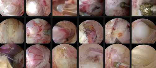 UBE手术培训国际报名表